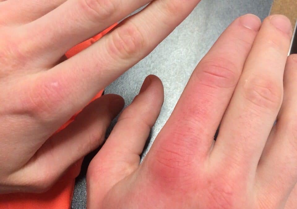 Cuando se cruza la línea del sobre-entrenamiento. Por el Instructor de Artes Marciales – Bernardo Volnié